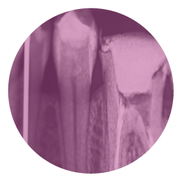 Endodoncja